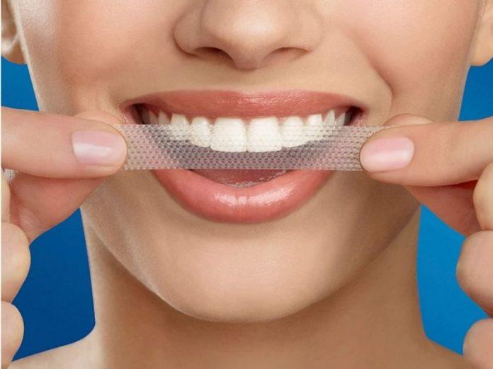Sử dụng miếng dán trắng răng là phương pháp làm trắng răng tại nhà hiệu quả và tiết kiệm (ảnh: internet)