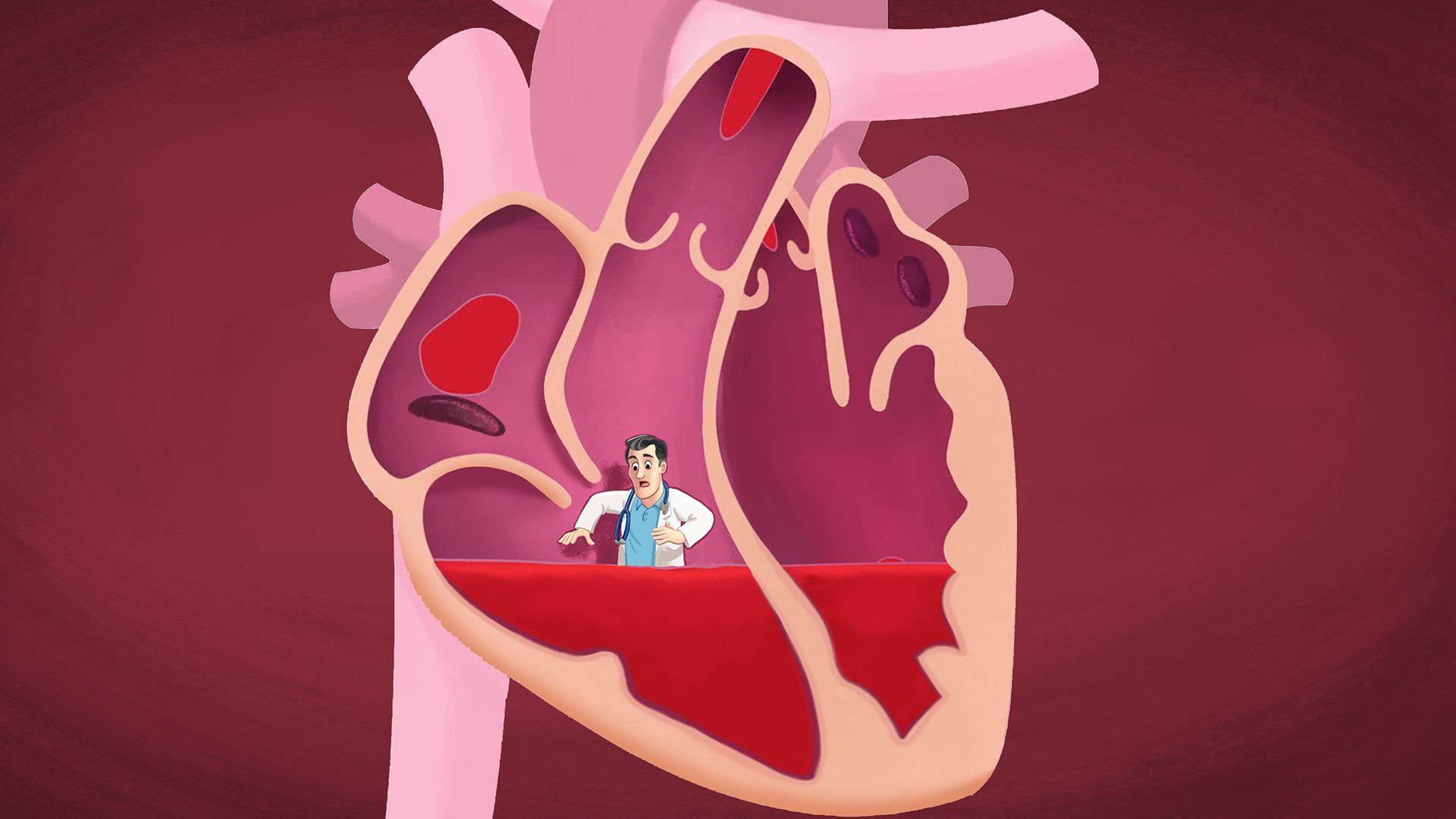 Đau ngực bên trái do bệnh lý của tim (Nguồn: Internet).