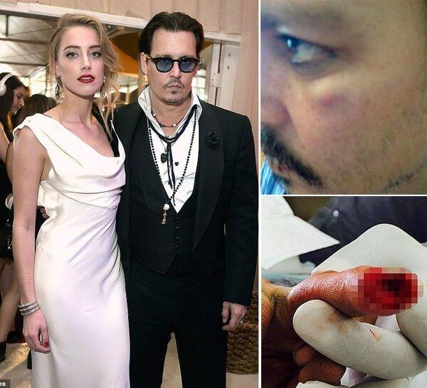 Ngón tay Johnny Depp bị đứt trong cuộc ẩu đả của hai người (Nguồn: Internet)