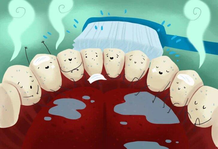 Cẩn thận với các căn bệnh về răng miệng như viêm lợi, sâu răng khi thở bằng miệng nhé (Ảnh: Internet)