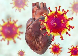 Người mắc bệnh tim mạch cần lưu ý gì đối với COVID-19?