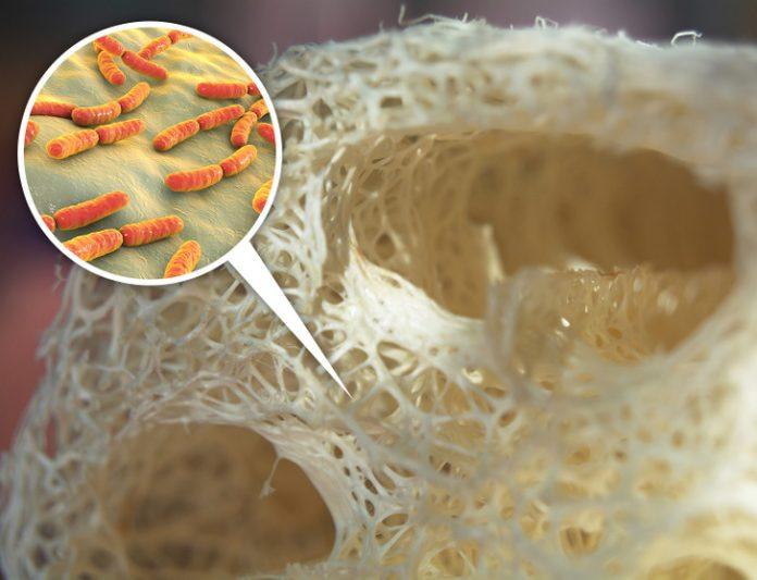 Các lỗ li ti trên xơ mướp hay bông tắm là môi trường trú ngụ hoàn hảo cho vi khuẩn (Ảnh: Internet)