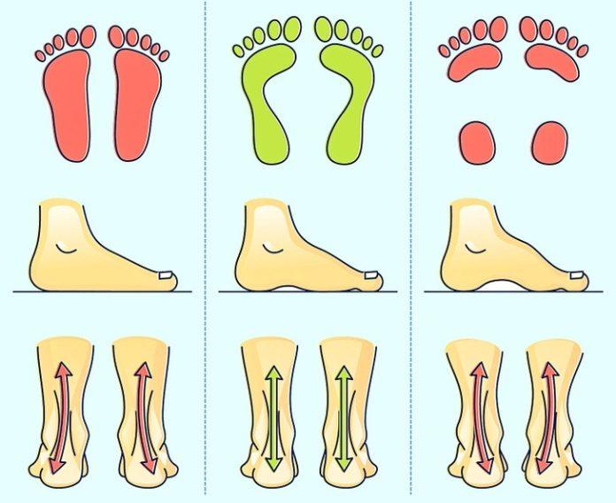 3 kiểu bàn chân từ trái sang phải: bàn chân phẳng, bàn chân bình thường, bàn chân cong vòm (Nguồn: Internet)