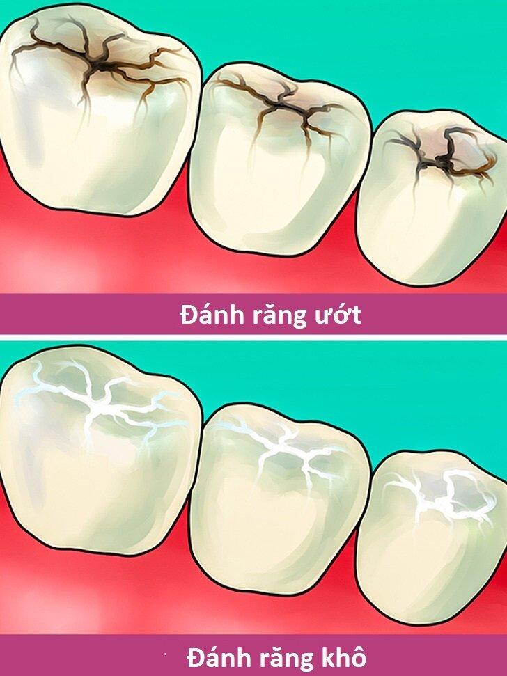 9 mẹo chăm sóc răng miệng giúp răng khỏe đẹp có thể bạn chưa biết ...