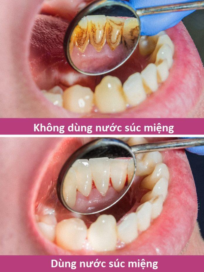 9 mẹo chăm sóc răng miệng giúp răng khỏe đẹp có thể bạn chưa biết ...