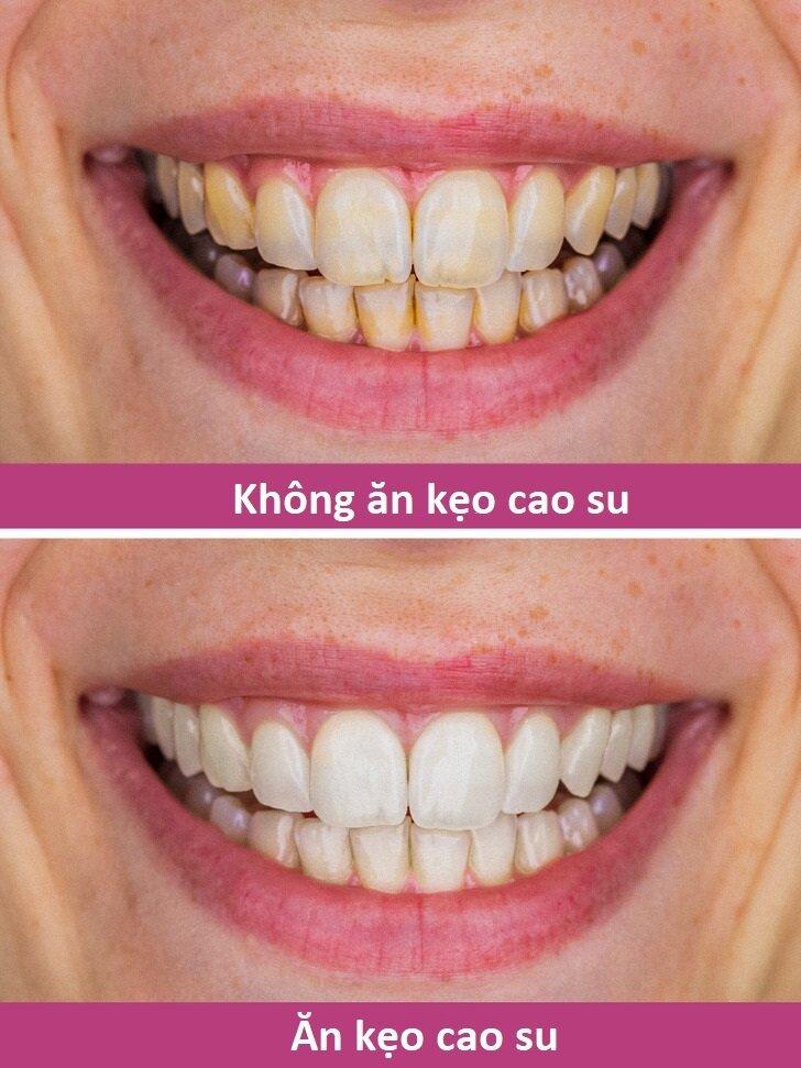 9 mẹo chăm sóc răng miệng giúp răng khỏe đẹp có thể bạn chưa biết ...