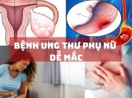 5 bệnh ung thư phụ nữ dễ mắc nhất