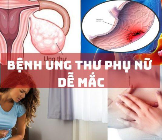 5 bệnh ung thư phụ nữ dễ mắc nhất
