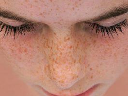 TĂNG SẮC TỐ DA & NHỮNG ĐIỀU CẦN BIẾT ( Nguồn: Internet )