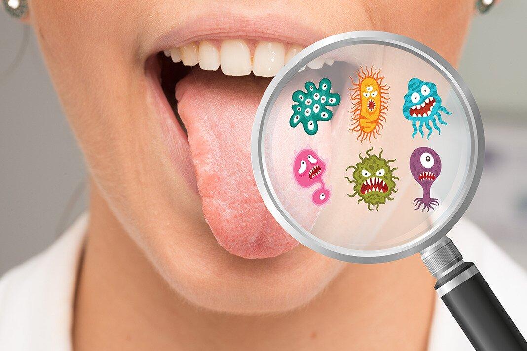 Trong miệng có rất nhiều vi khuẩn tồn tại, kể cả trên lưỡi (Ảnh: Internet)