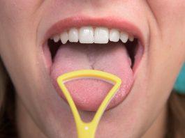 Dụng cụ cạo lưỡi có hình dạng như móng ngựa (Ảnh: Internet)