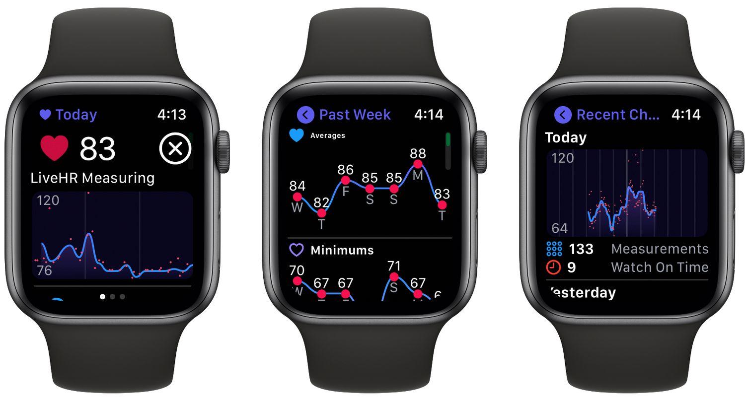 Ứng dụng theo dõi sức khỏe tim mạch Heart Analyzer trên đồng hồ thông minh Apple Watch (Ảnh: Internet).