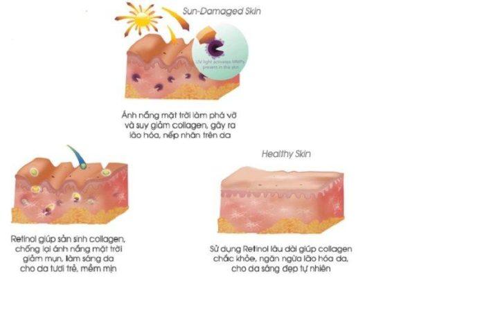 Retinol hoạt động trên da như thế nào (nguồn: Internet)
