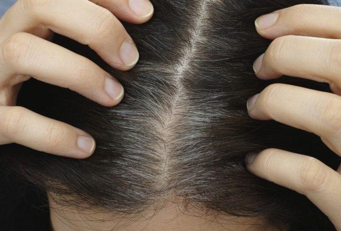 Dầu gội phủ bạc Sin Hair là cái tên được nhiều người nghĩ tới. (Nguồn: Internet).