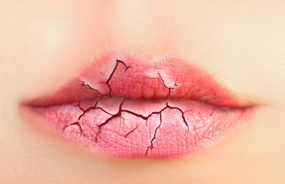 Không tẩy da chết khi môi đang bị thương (Ảnh: internet)