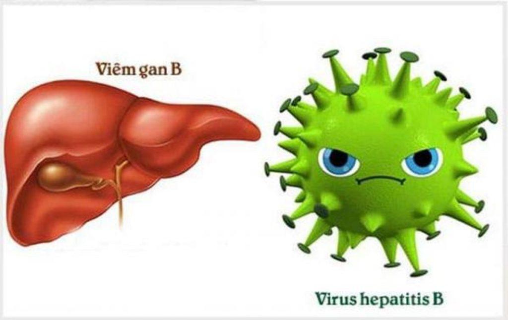 Điều trị bệnh viêm gan B (Nguồn: Internet)