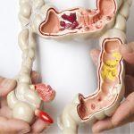 Trĩ nội do nguyên nhân gì? Triệu chứng và cách phòng ngừa ra sao?