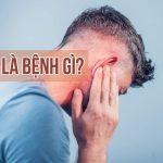 Nguyên nhân gây ra ù tai và phương pháp phòng ngừa hiệu quả nhất