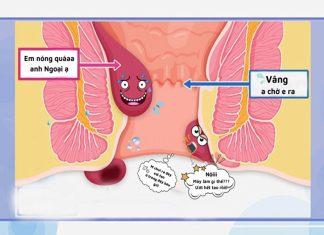 Dấu hiệu nhận biết bệnh trĩ mà bạn không nên bỏ qua
