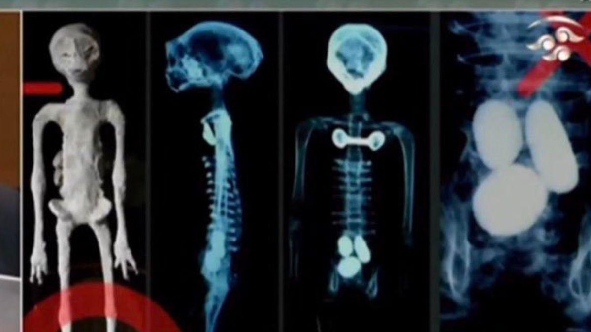 Hình chụp X-quang của "hài cốt người ngoài hành tinh" (Ảnh: Internet)