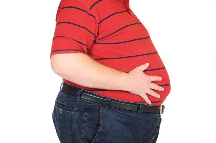 Bệnh béo phì(Nguồn: Vinmec.com)