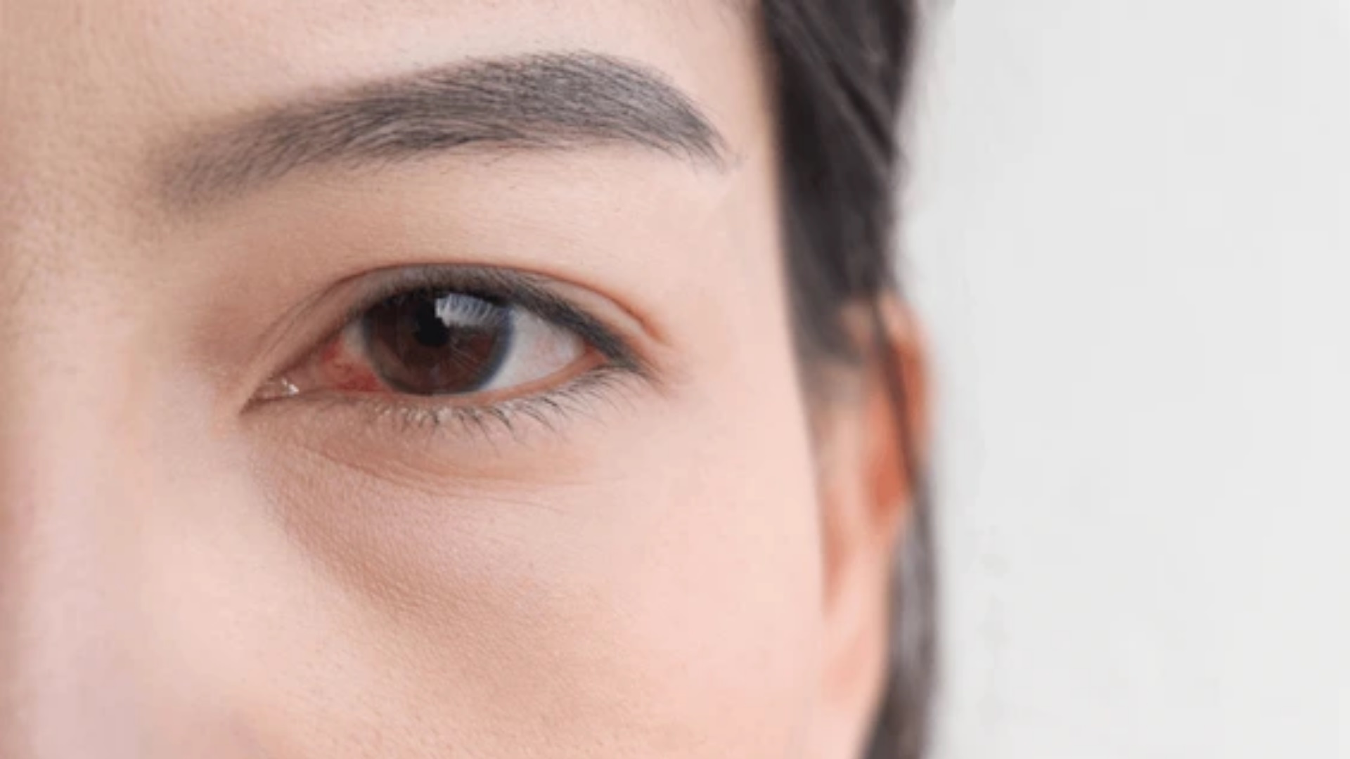Vùng da mắt mỏng, cần có sản phẩm chăm sóc riêng như tinh chất mắt Lorsia.