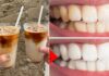 Cách ngăn răng bị ố vàng khi uống cafe (Ảnh: Internet)