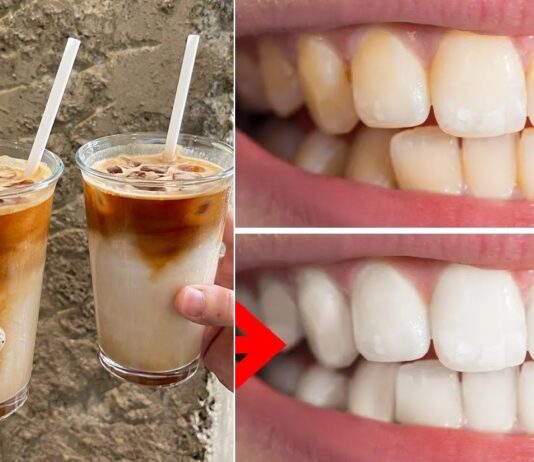 Cách ngăn răng bị ố vàng khi uống cafe (Ảnh: Internet)