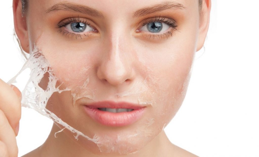 Cần những phương pháp chăm sóc dưỡng ẩm để khắc phục tình trạng da khô (Nguồn: Internet)