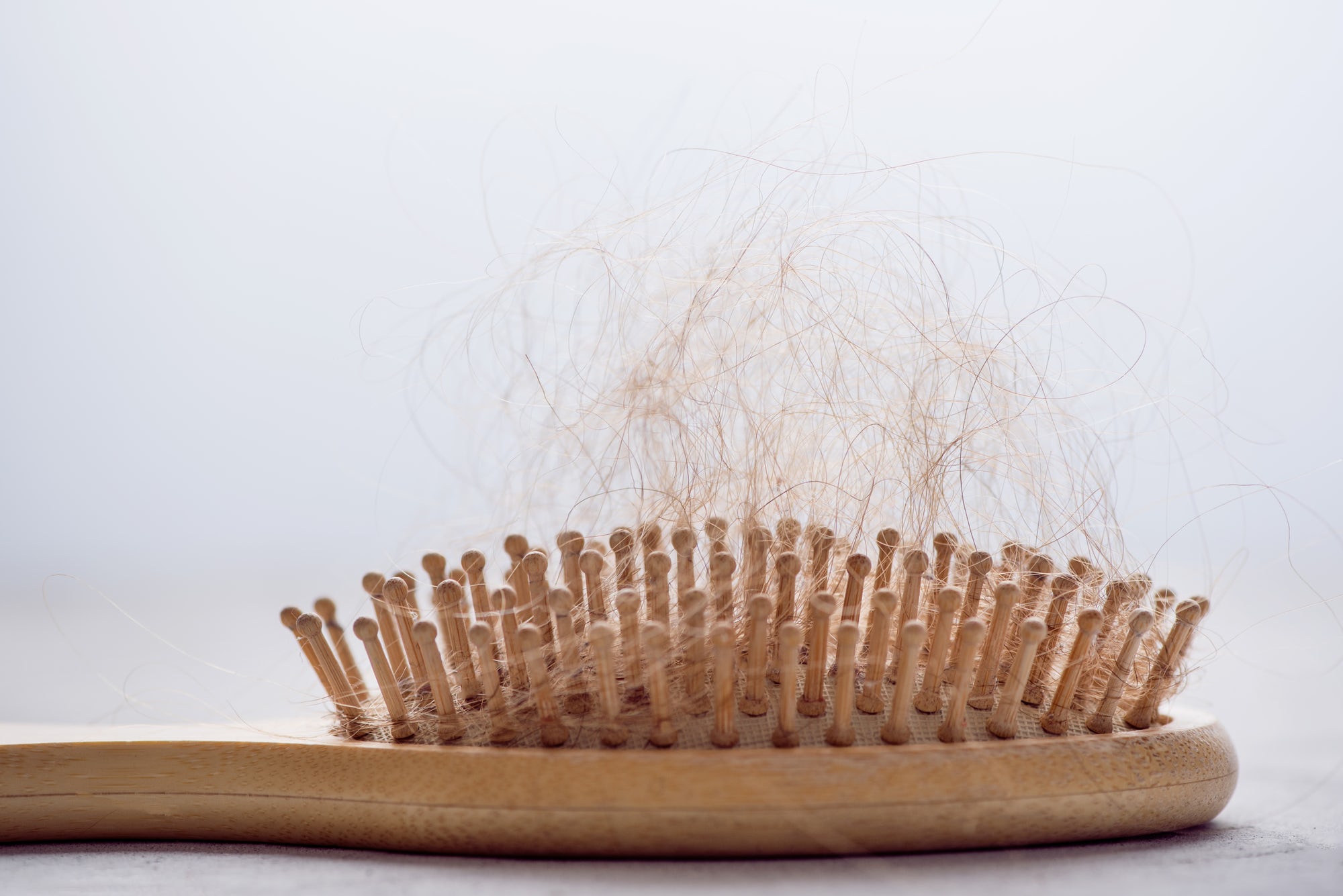 Do phải thường xuyên cột, buộc chặt nên tóc không tránh khỏi tình trạng gãy rụng (Nguồn: Internet)