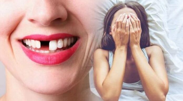 Giấc mơ cảnh báo sức khỏe: Mơ bị rụng răng (Ảnh: Internet)