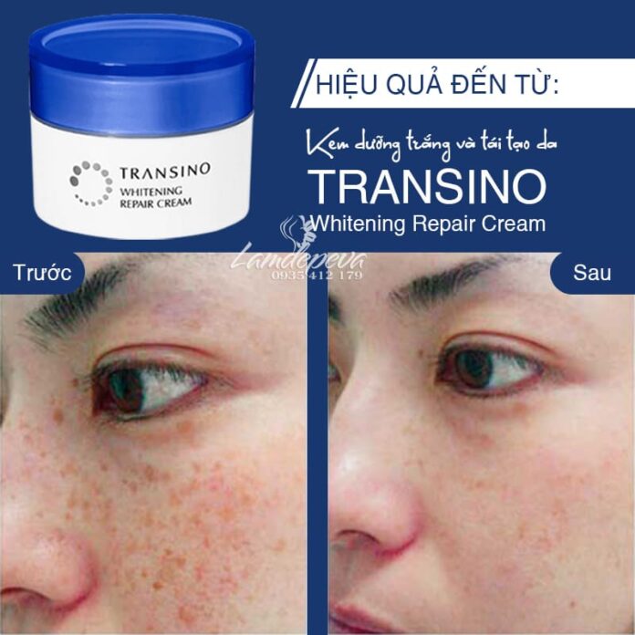 Hiệu quả trước và sau của kem Transino Whitening Repair Cream EX (Nguồn: Internet)