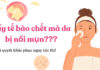 Vì sao tẩy tế bào chết da bị nổi mụn? (nguồn: BlogAnChoi)