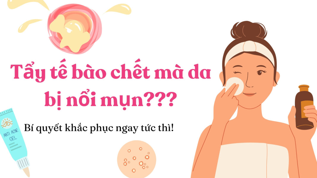 Vì sao tẩy tế bào chết da bị nổi mụn? (nguồn: BlogAnChoi)