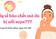 Vì sao tẩy tế bào chết da bị nổi mụn? (nguồn: BlogAnChoi)