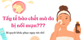 Vì sao tẩy tế bào chết da bị nổi mụn? (nguồn: BlogAnChoi)