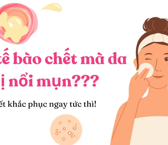 Vì sao tẩy tế bào chết da bị nổi mụn? (nguồn: BlogAnChoi)