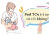 Peel TCA trị sẹo có tốt không? (nguồn: BogAnChoi)