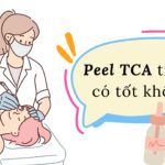 Peel TCA trị sẹo có tốt không? (nguồn: BogAnChoi)