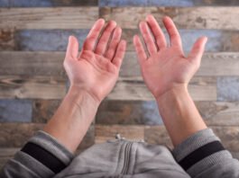 Lòng bàn tay son (Palmar Erythema): Nguyên nhân, dấu hiệu, cách điều trị và phòng ngừa Có nhiều nguyên nhân gây ra tình trạng lòng bàn tay son (Ảnh: Internet)