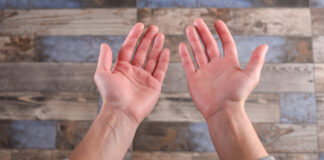 Có nhiều nguyên nhân gây ra tình trạng lòng bàn tay son (Ảnh: Internet)