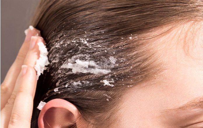 Tẩy tế bào chết cho da đầu