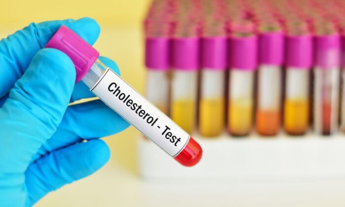 Xét nghiệm cholesterol
