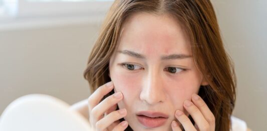 Dấu hiệu cho thấy bạn nên ngừng sử dụng retinol