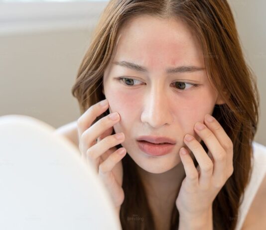 Dấu hiệu cho thấy bạn nên ngừng sử dụng retinol