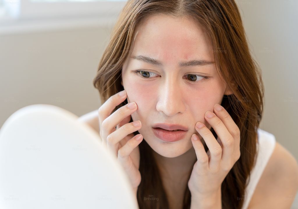 “Bỏng” retinol