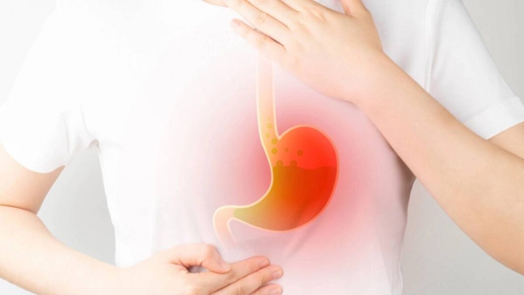 12 thực phẩm có lợi cho việc kiểm soát trào ngược dạ dày thực quản (GERD)