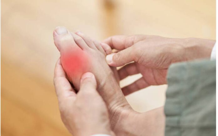 Đau dữ dội ở ngón chân cái