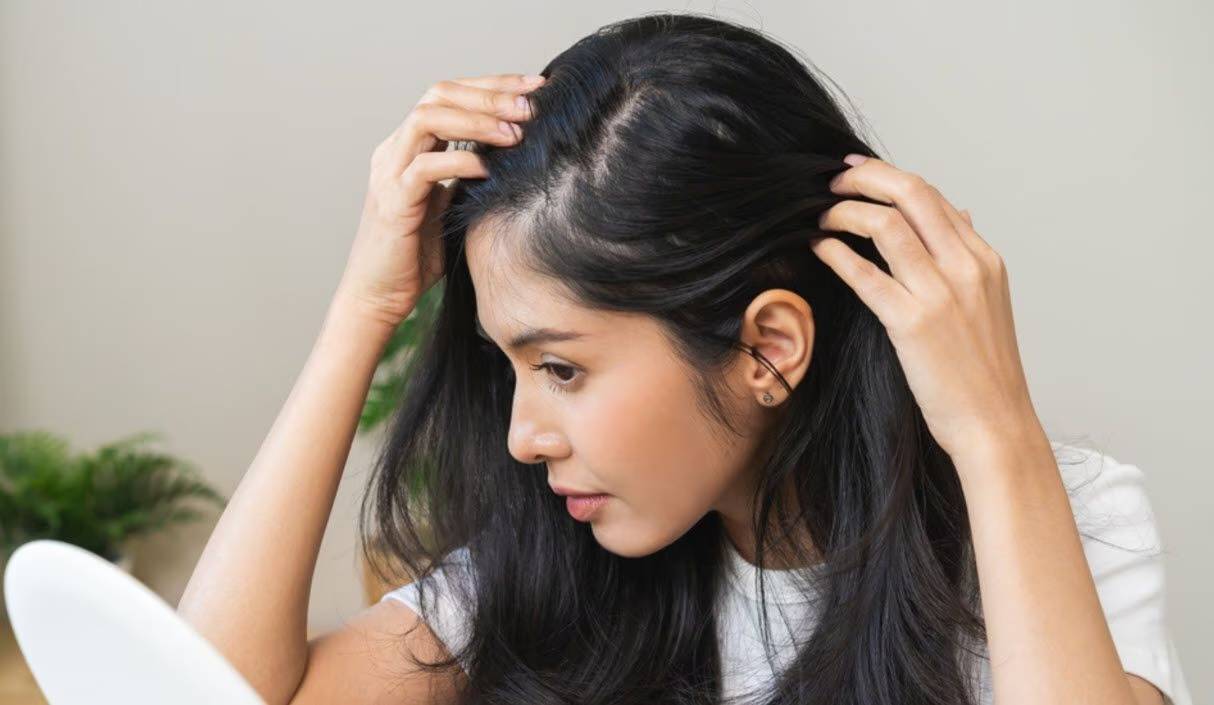 Hầu hết các trường hợp, gàu có thể được kiểm soát dễ dàng tại nhà bằng các sản phẩm phù hợp Hầu hết các trường hợp, gàu có thể được kiểm soát dễ dàng tại nhà bằng các sản phẩm phù hợp