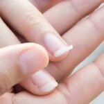 Móng giòn, dễ gãy: Nguyên nhân, cách khắc phục và những lưu ý Móng giòn, dễ gãy